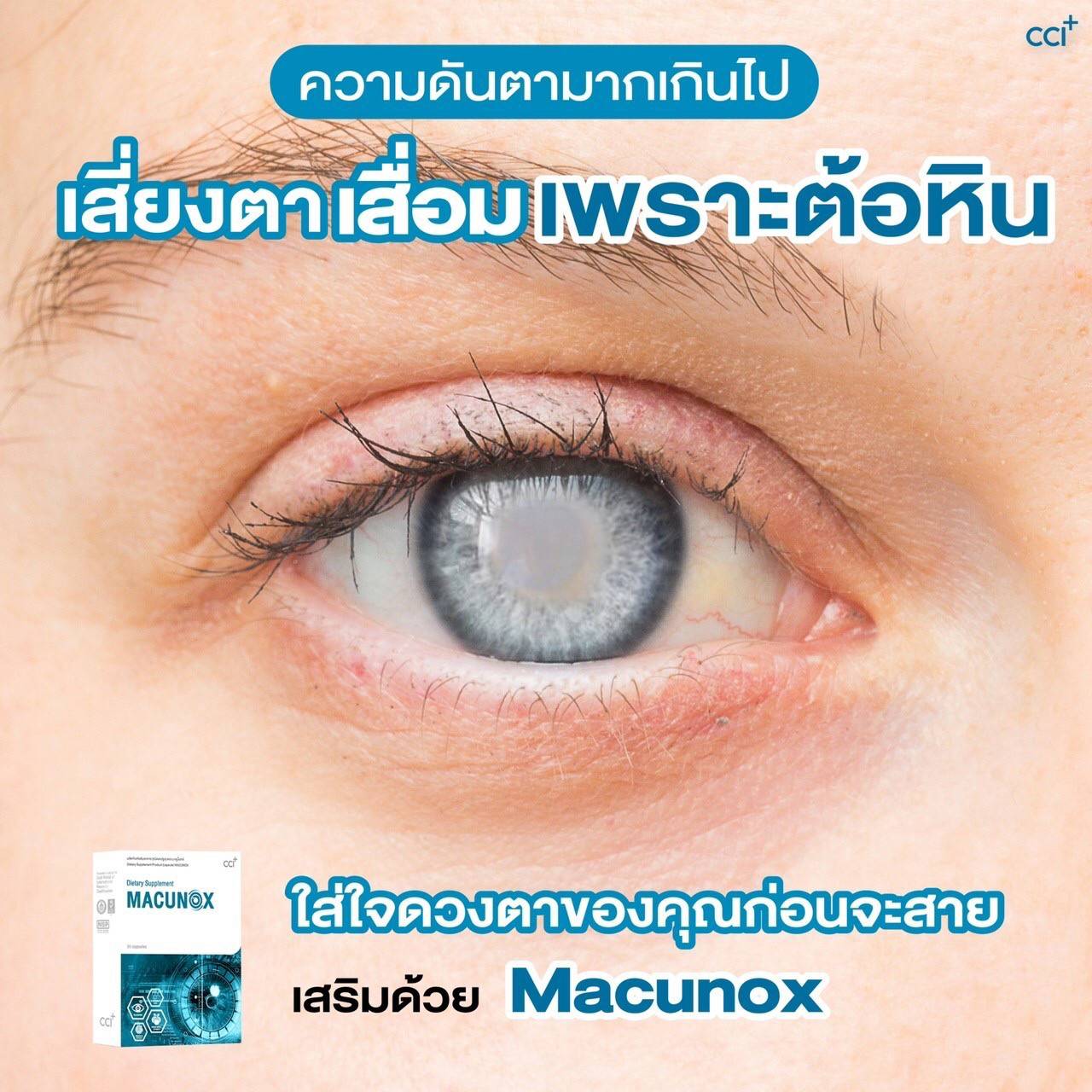 มาคูน็อกซ์ Macunox